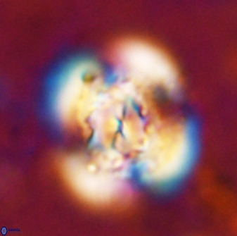 Watznaueria cauveryensis 36344