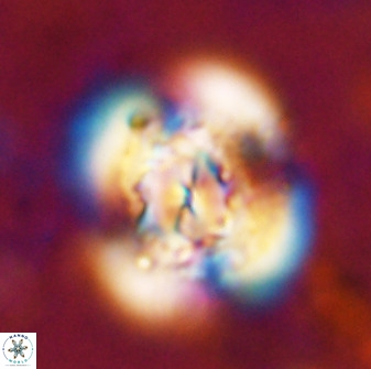 Watznaueria cauveryensis 36344