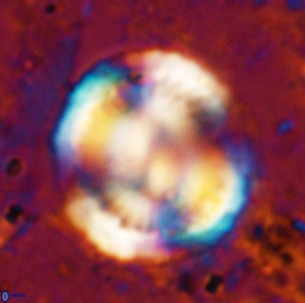 Watznaueria cauveryensis 36345