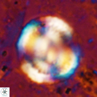 Watznaueria cauveryensis 36345