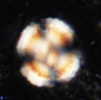 Watznaueria cauveryensis 36346