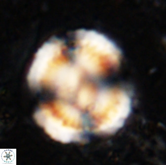 Watznaueria cauveryensis 36346
