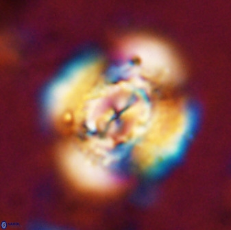 Watznaueria cauveryensis 36348