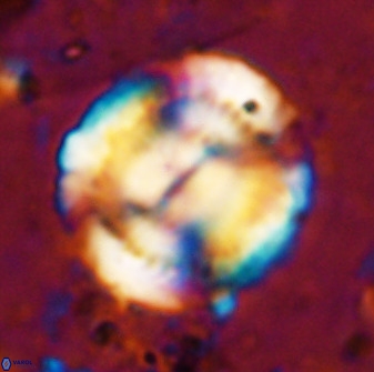 Watznaueria cauveryensis 36352