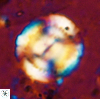 Watznaueria cauveryensis 36352