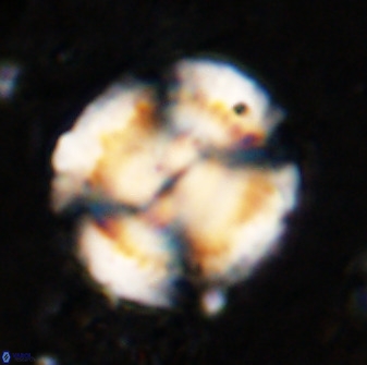 Watznaueria cauveryensis 36353