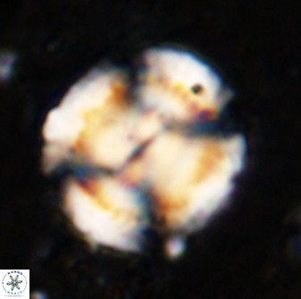 Watznaueria cauveryensis 36353