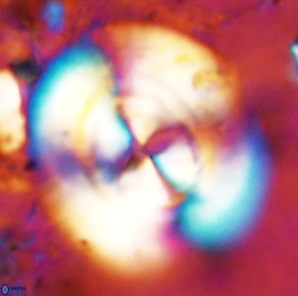 Watznaueria cauveryensis 38817