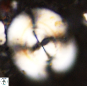 Watznaueria cauveryensis 38818