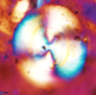 Watznaueria cauveryensis 38821