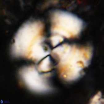 Watznaueria cauveryensis 38822