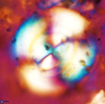 Watznaueria cauveryensis 38823