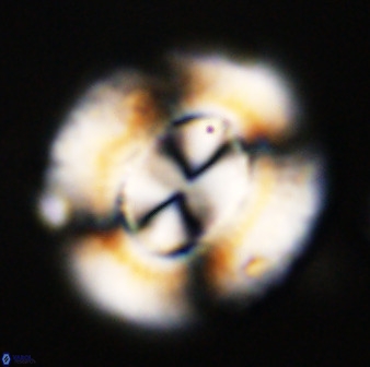 Watznaueria cauveryensis 39853