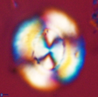 Watznaueria cauveryensis 39855