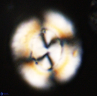 Watznaueria cauveryensis 39856