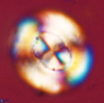 Watznaueria cauveryensis 39858
