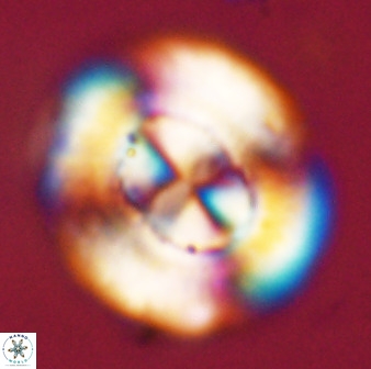 Watznaueria cauveryensis 39858
