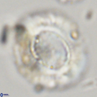 Watznaueria cauveryensis 39859