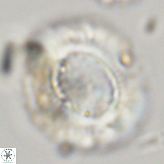 Watznaueria cauveryensis 39859