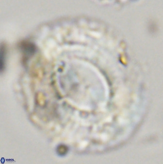 Watznaueria cauveryensis 39860