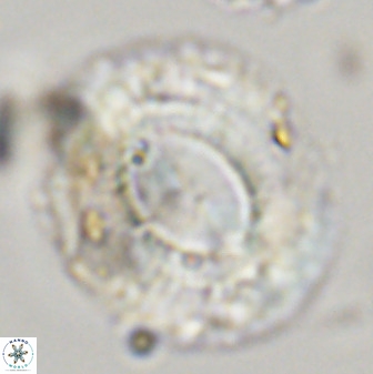 Watznaueria cauveryensis 39860