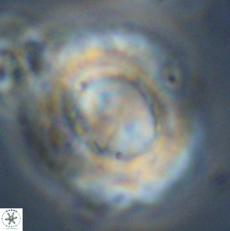 Watznaueria cauveryensis 39861