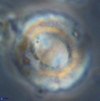 Watznaueria cauveryensis 39862