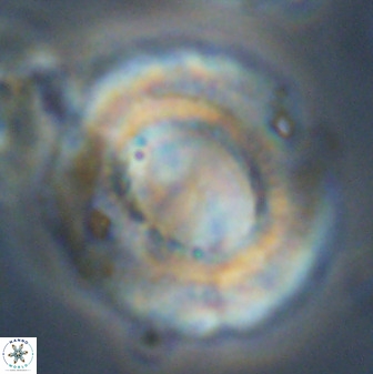Watznaueria cauveryensis 39862