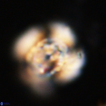 Watznaueria cauveryensis 40602