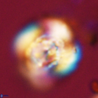 Watznaueria cauveryensis 40604