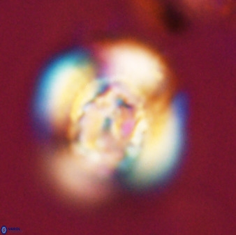 Watznaueria cauveryensis 40605