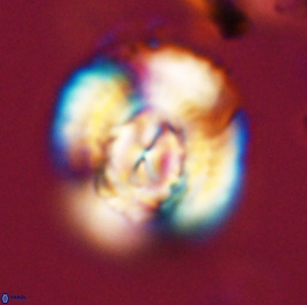 Watznaueria cauveryensis 40608