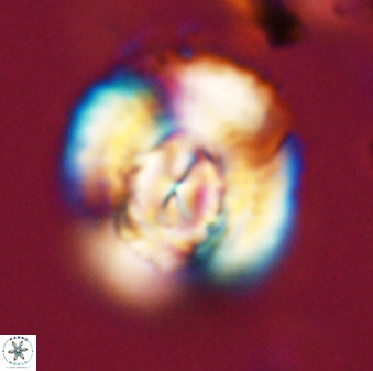 Watznaueria cauveryensis 40608