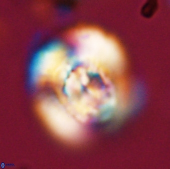 Watznaueria cauveryensis 40609
