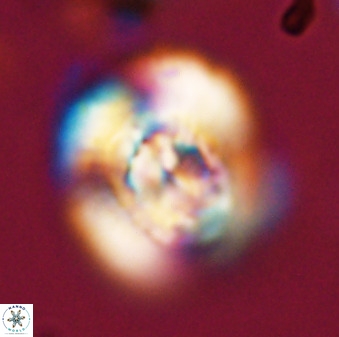 Watznaueria cauveryensis 40609