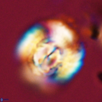 Watznaueria cauveryensis 40613