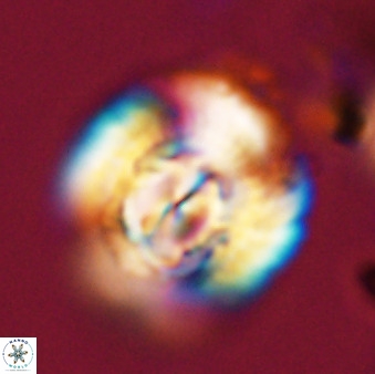 Watznaueria cauveryensis 40613