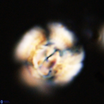 Watznaueria cauveryensis 40614