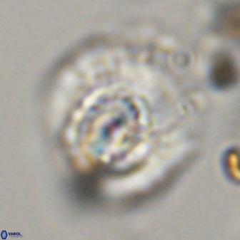Watznaueria cauveryensis 40616