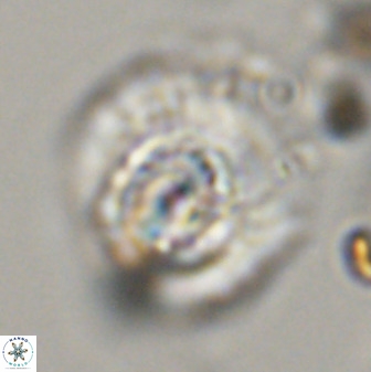 Watznaueria cauveryensis 40616