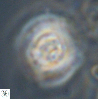 Watznaueria cauveryensis 40618