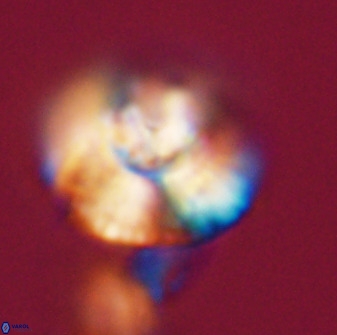 Watznaueria cauveryensis 40622