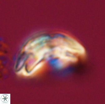 Watznaueria cauveryensis 40625