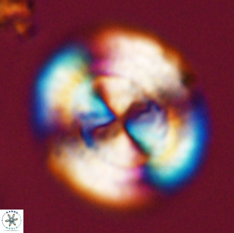 Watznaueria cauveryensis 41928