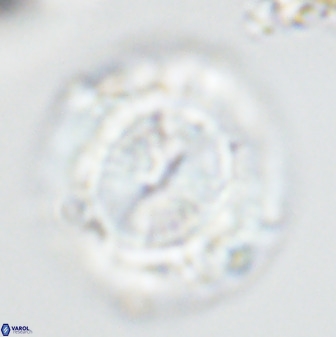 Watznaueria cauveryensis 41931