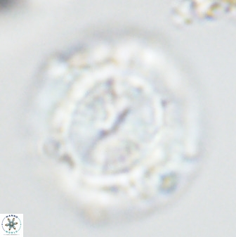 Watznaueria cauveryensis 41931