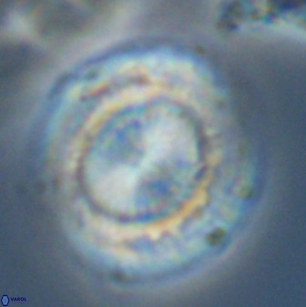 Watznaueria cauveryensis 41932