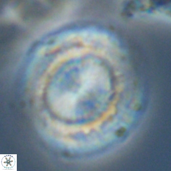 Watznaueria cauveryensis 41932