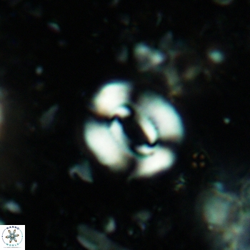 Watznaueria coronata 5238