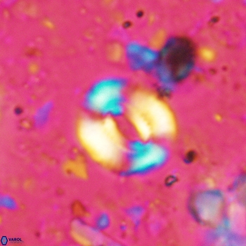 Watznaueria coronata 5239